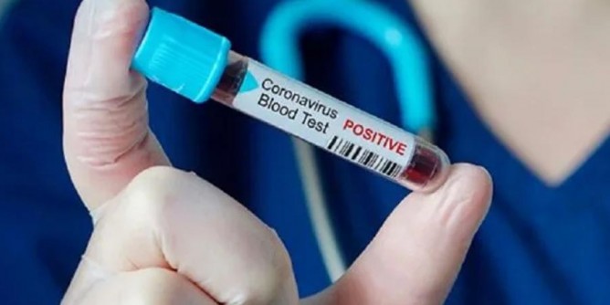 329 <i>positivi</i>, 121 nel Sassarese