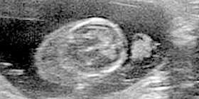 Diagnostica per immagini: riduzione tempi dattesa